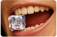 sensibilitate dentara